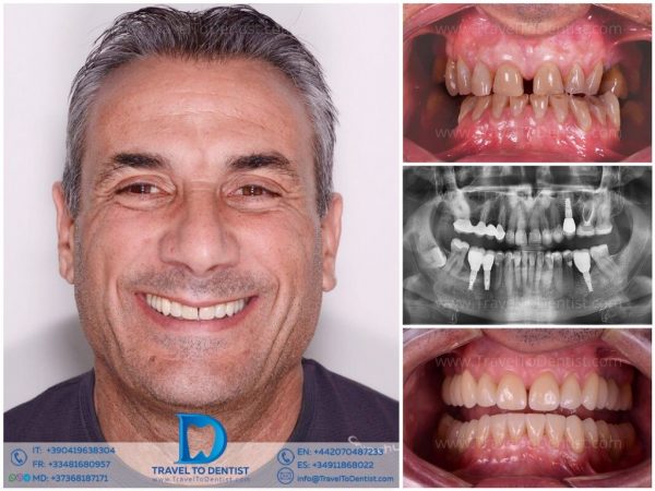 Caso clínico 2 — resultado dental